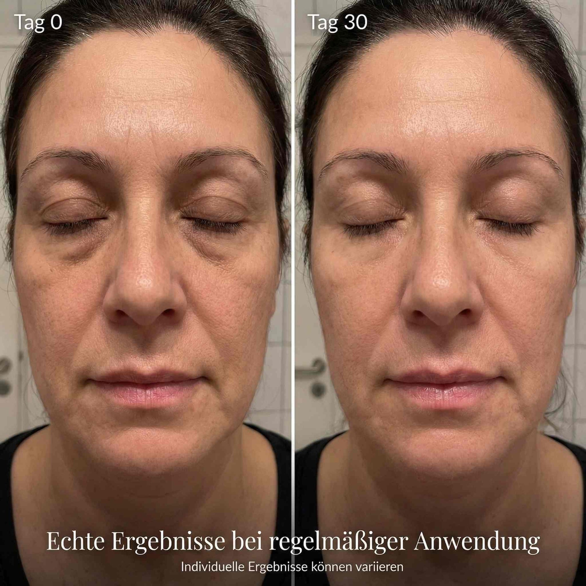 EyeLift - EMS & Red Light Eye Treatment System