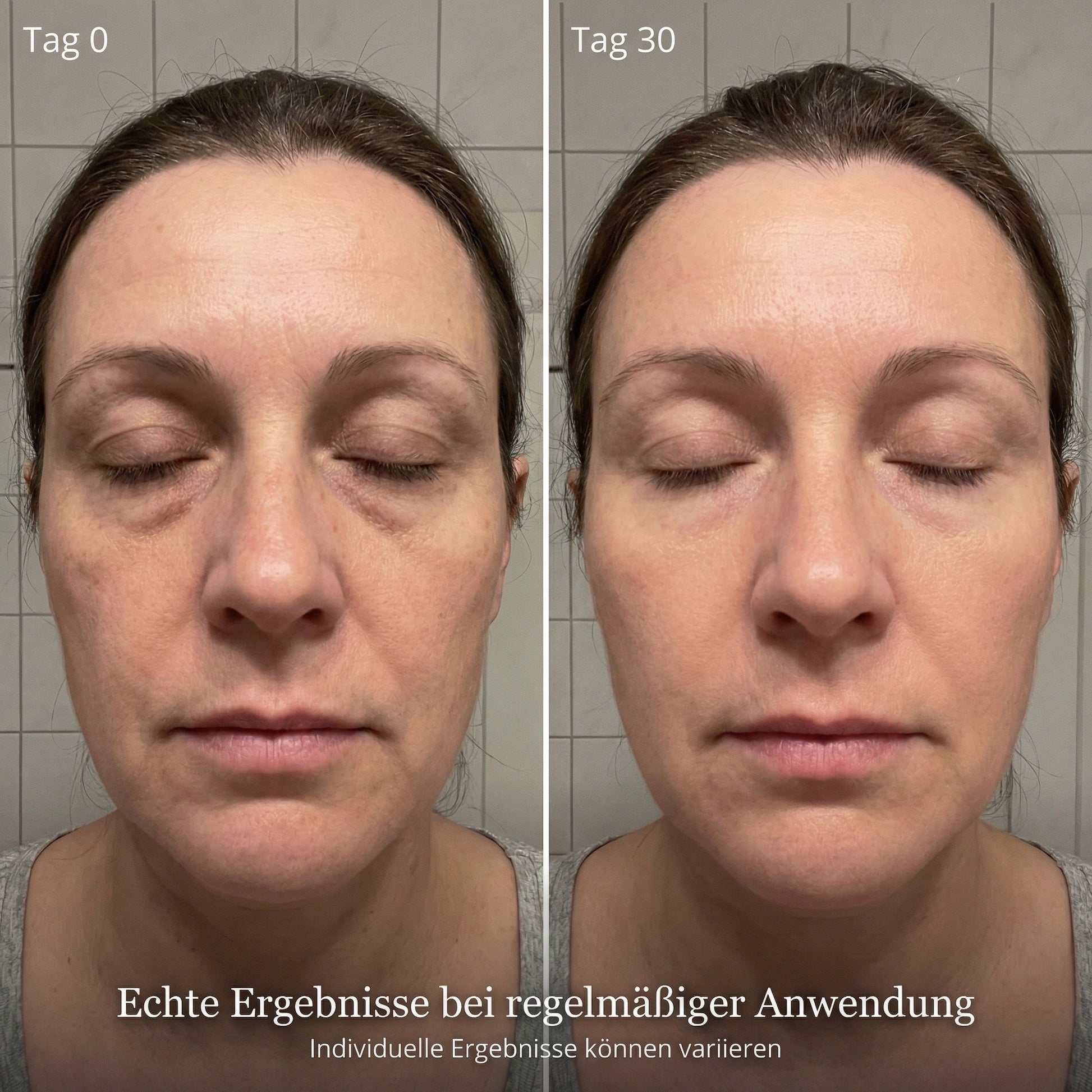 EyeLift - EMS & Red Light Eye Treatment System