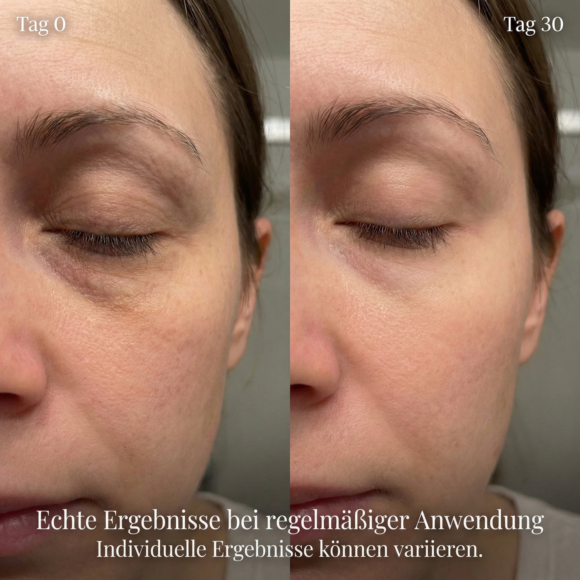 EyeLift - EMS & Red Light Eye Treatment System